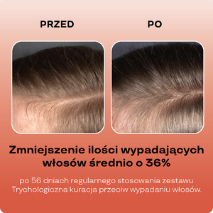 Stimulierendes Shampoo gegen Haarausfall mit 3% Niacinamid, Vitamin B6 und fermentiertem Ginseng-Extraktt 